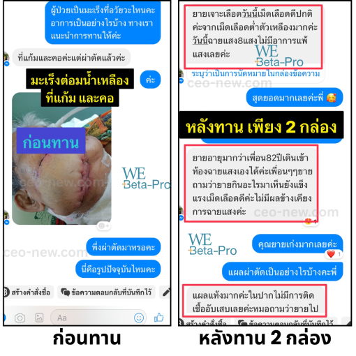 WE BETA PRO - Image 7